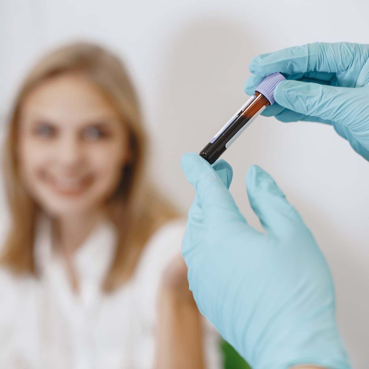 blood tests for hair loss