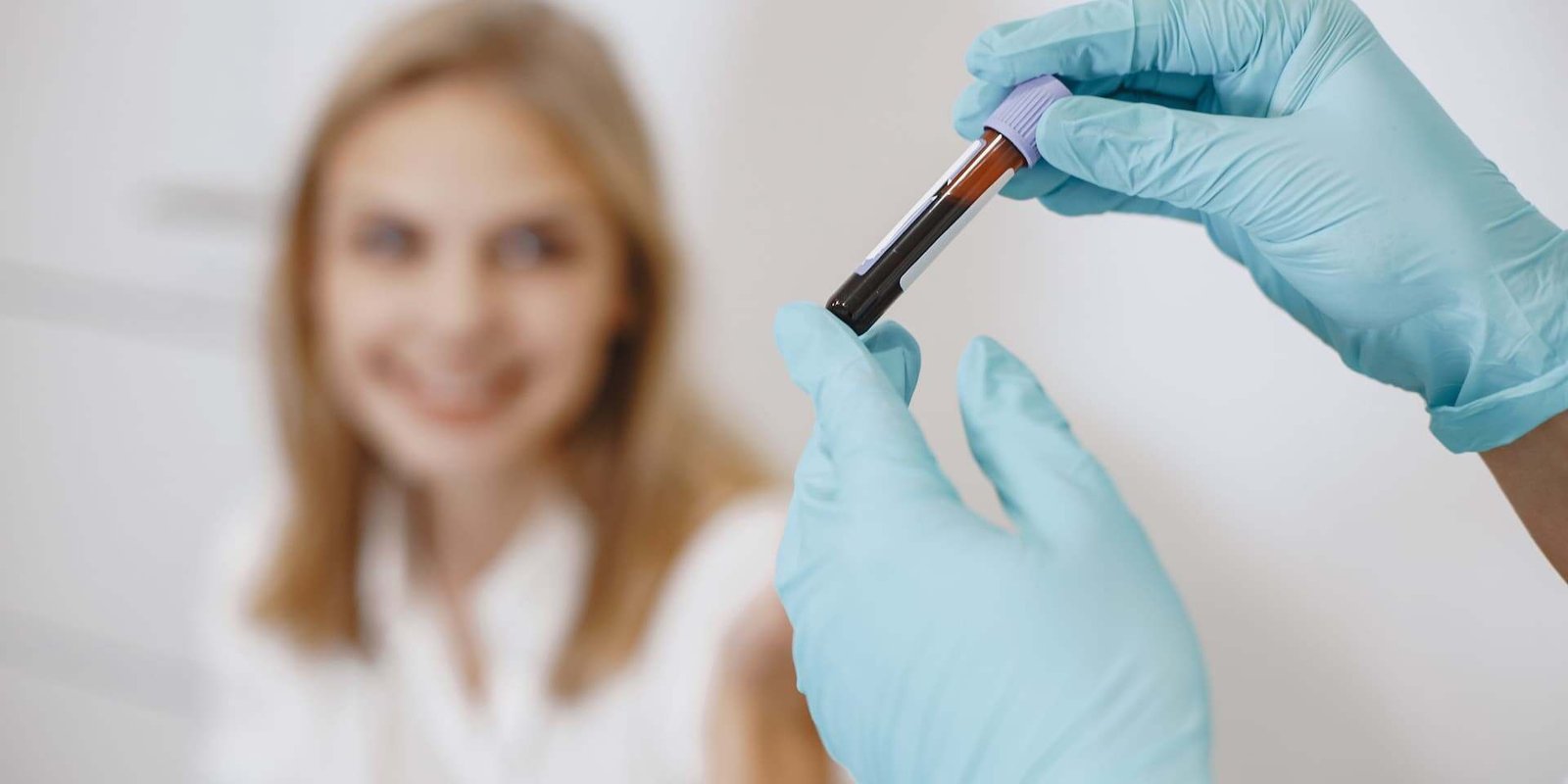 The Blood Tests Your Hair Actually Needs (And Why Your GP Probably Didn't Run Them) The Blood Tests Your Hair Actually Needs 2 uai