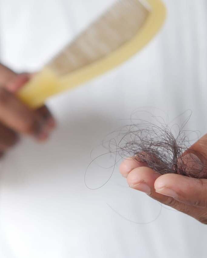 GLP-1 hair shedding — Hair Health Essentials