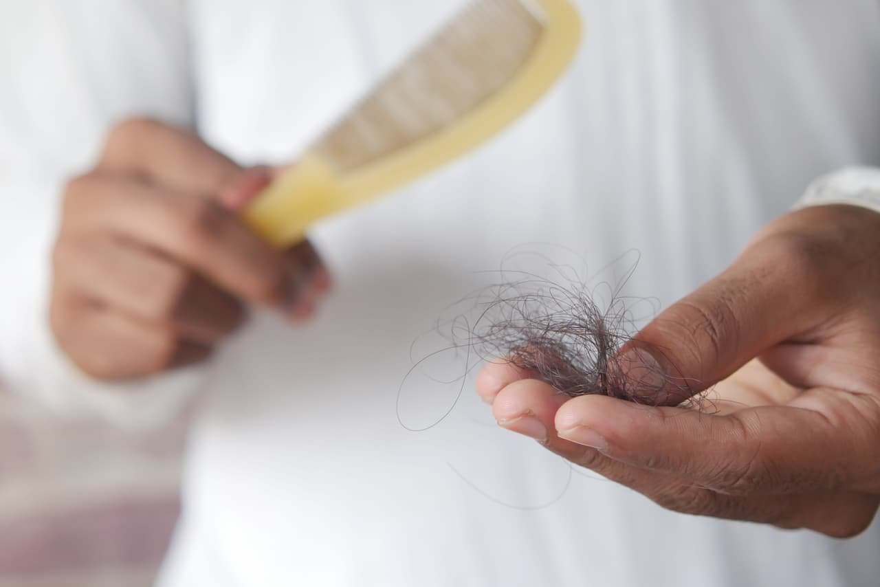 GLP-1 hair shedding — Hair Health Essentials