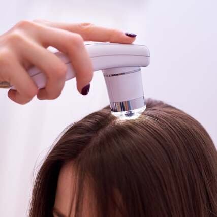 Microscopic examination of the hair and skin of the scalp. HHE Longevity 6 uai